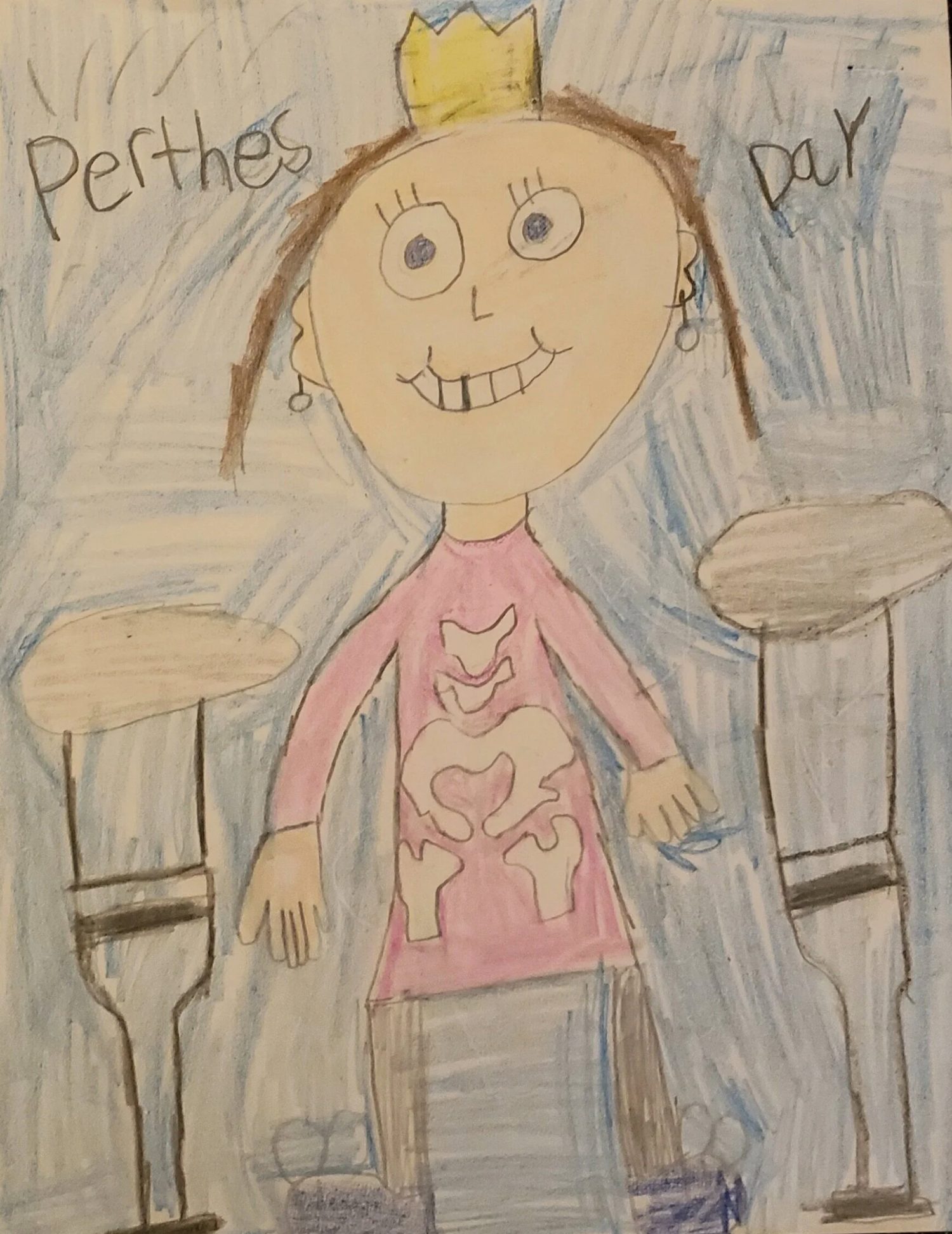 Child's drawing of a princess showing her hip bones — 'Perthes Day'