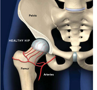 Healthy hip with blood flowing to the femoral head