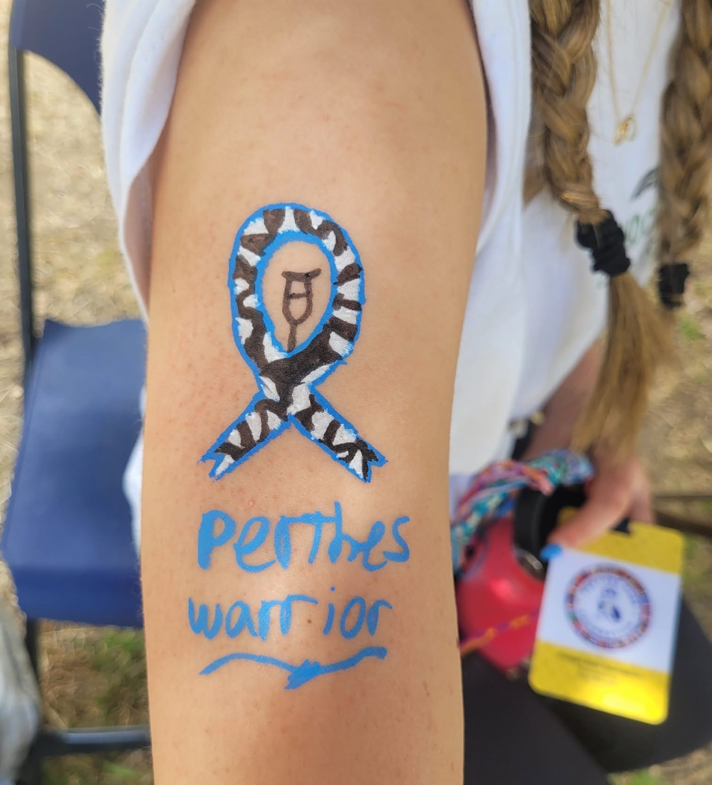 A blue-and-zebra-striped awareness ribbon with a tiny crutch painted on a camper's arm, with the words 'Perthes warrior' below in blue face paint