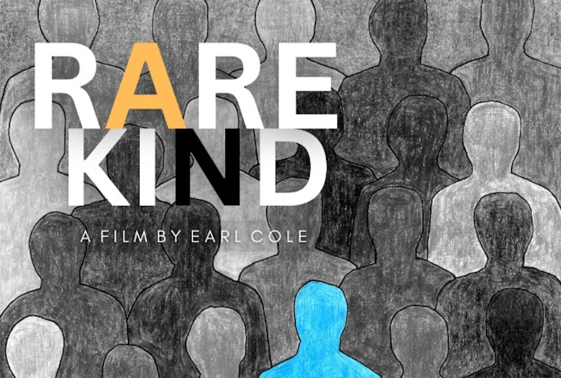 Rare Kind — a Perthes documentary by Earl Cole